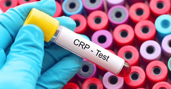 CRP Test: Procedure and Price